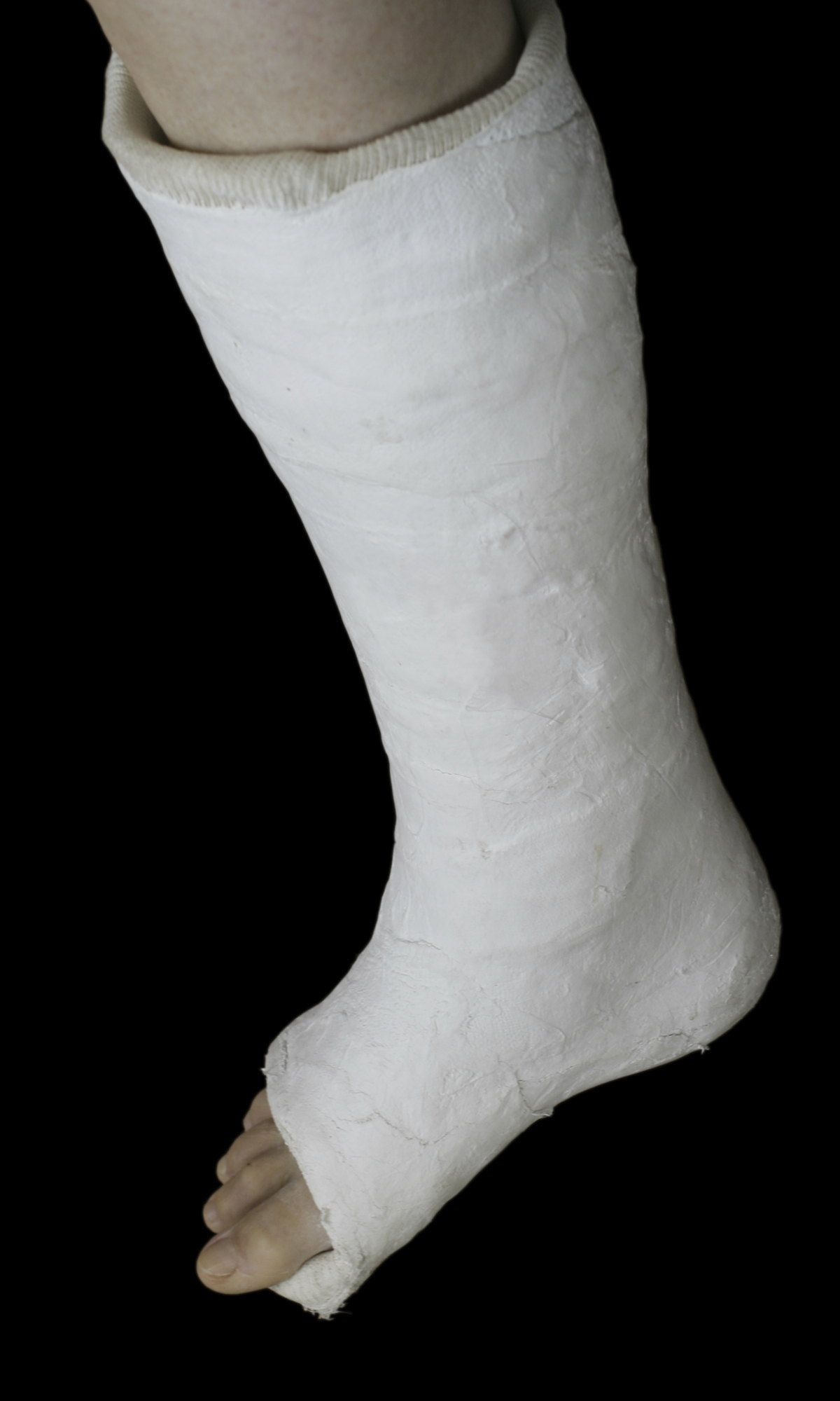 Sever's Disease (Heel Pain) - OrthoInfo - AAOS